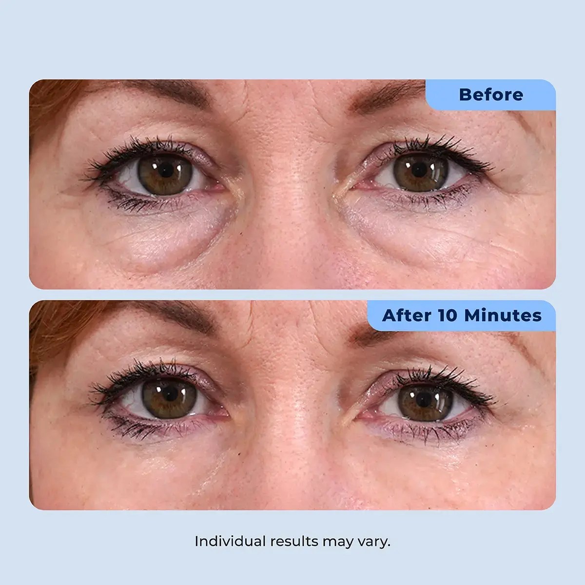 Rapid Reduction Serum