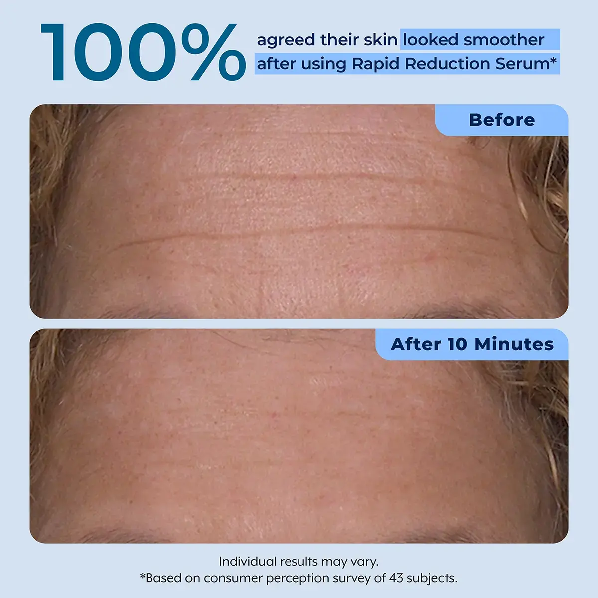 Rapid Reduction Serum