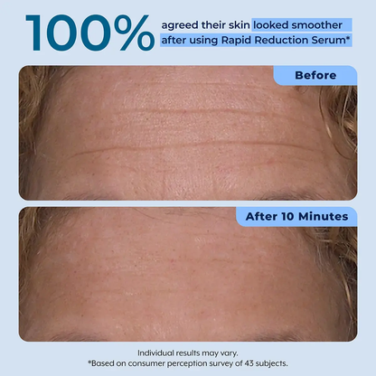 Rapid Reduction Serum