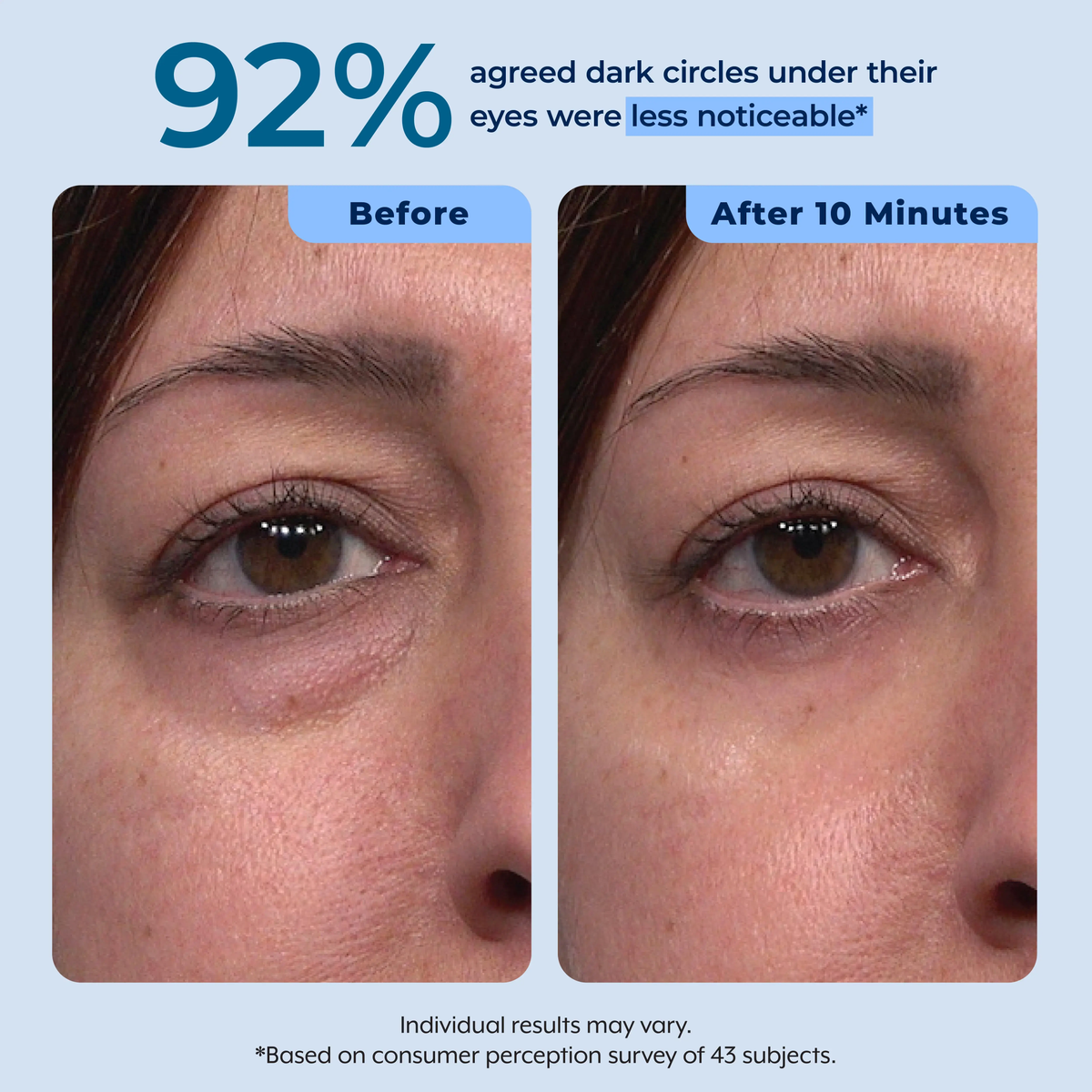 Rapid Reduction Serum