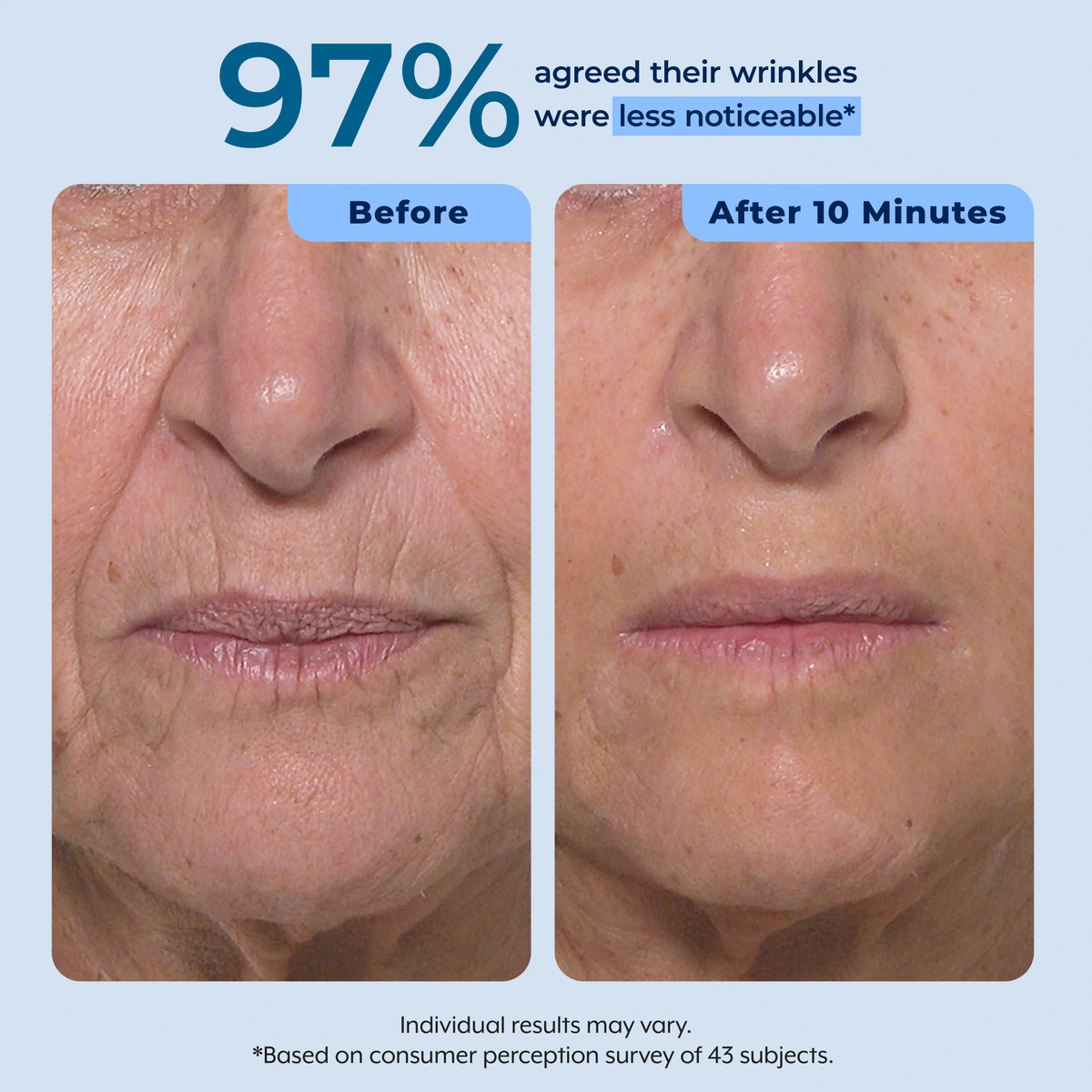 Rapid Reduction Serum