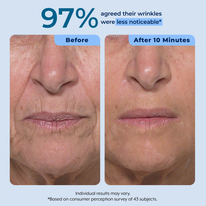 Rapid Reduction Serum